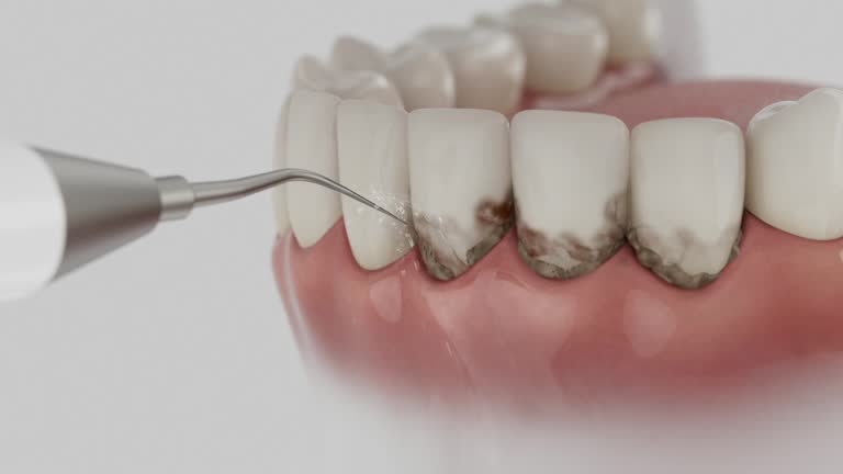 Trusted Root Canal Treatment service in Burleson, TX - Dentist Open Now
